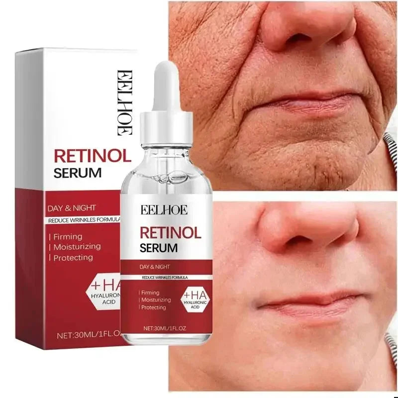 Retinol Anti-Aging Face Serum Set — Firms, Lifts & Fades Fine Lines - Gold Store Business