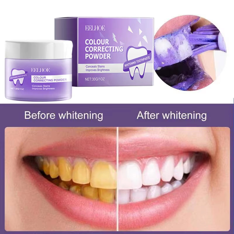 5-Day Teeth Whitening Powder — Remove Plaque, Stains & Bad Breath - Gold Store Business