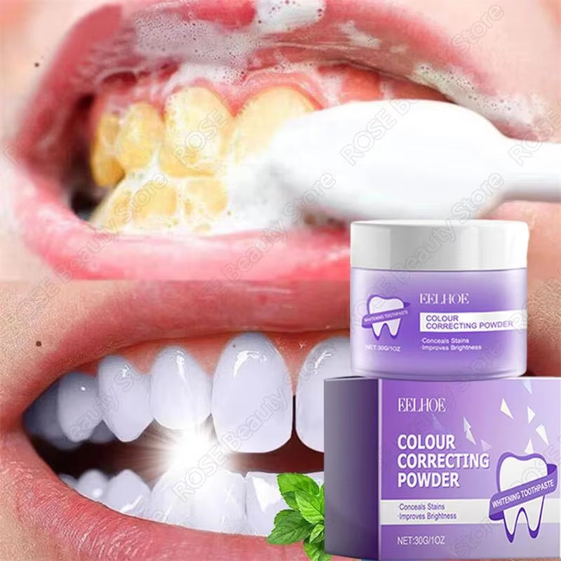 5-Day Teeth Whitening Powder — Remove Plaque, Stains & Bad Breath - Gold Store Business