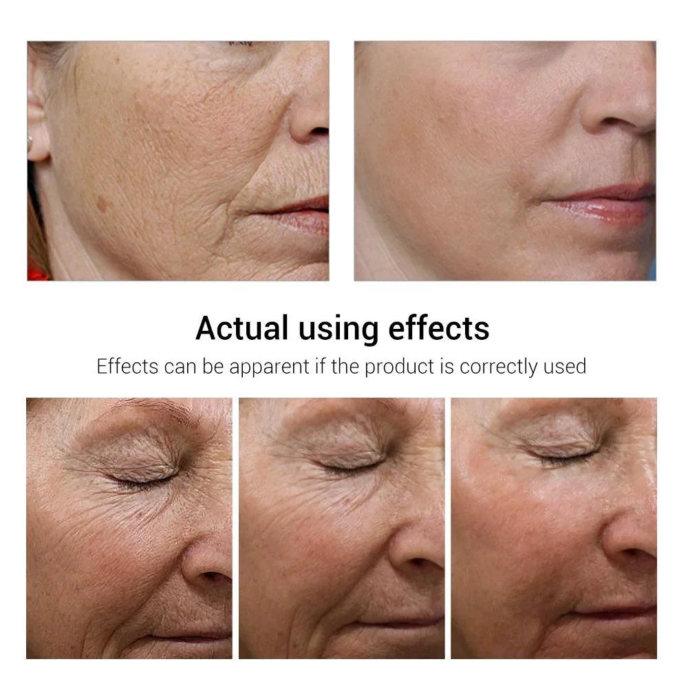 Retinol Anti-Aging Face Serum Set — Firms, Lifts & Fades Fine Lines - Gold Store Business