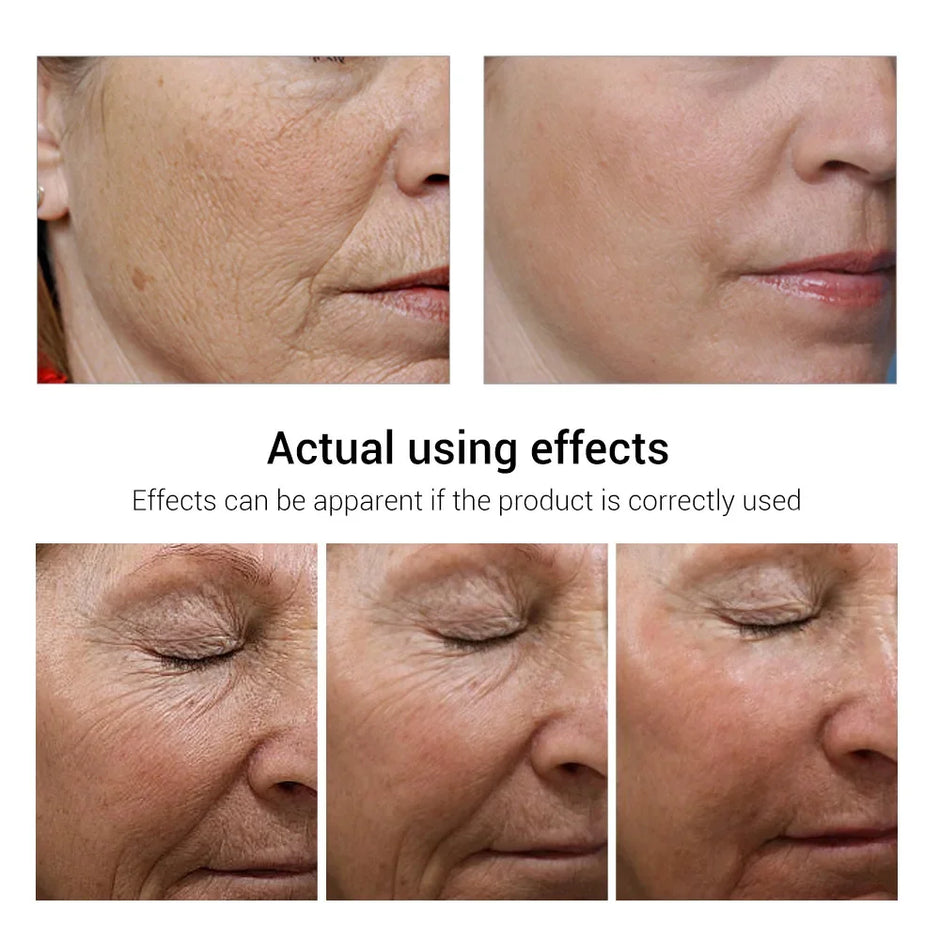 Retinol Anti-Aging Face Serum Set — Firms, Lifts & Fades Fine Lines - Gold Store Business