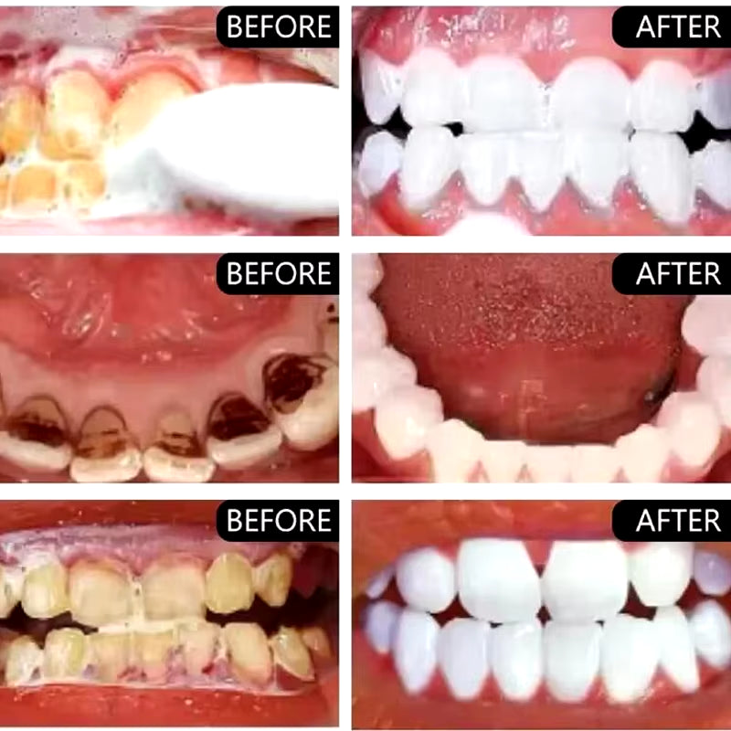 5-Day Teeth Whitening Powder — Remove Plaque, Stains & Bad Breath - Gold Store Business