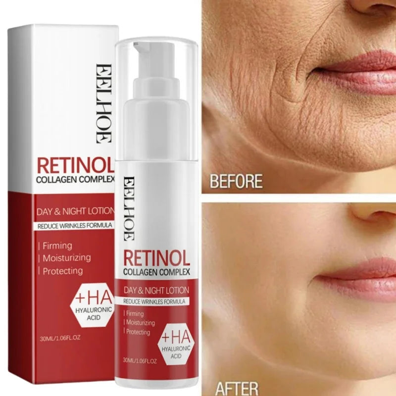 Retinol Anti-Aging Face Serum Set — Firms, Lifts & Fades Fine Lines - Gold Store Business