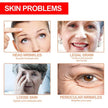 Retinol Anti-Aging Face Serum Set — Firms, Lifts & Fades Fine Lines - Gold Store Business