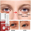 Retinol Anti-Aging Face Serum Set — Firms, Lifts & Fades Fine Lines - Gold Store Business