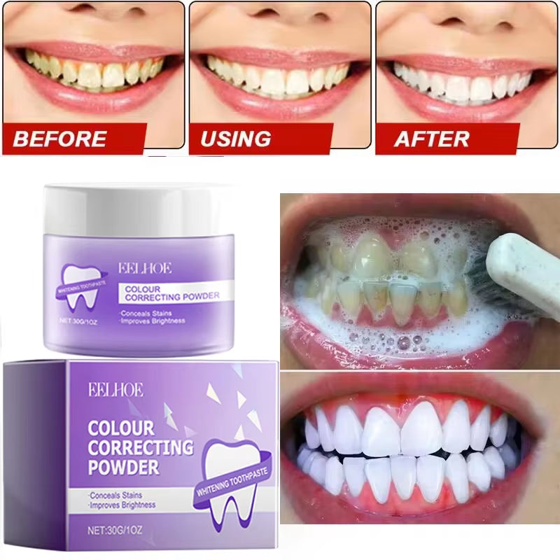 5-Day Teeth Whitening Powder — Remove Plaque, Stains & Bad Breath - Gold Store Business