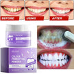 5-Day Teeth Whitening Powder — Remove Plaque, Stains & Bad Breath - Gold Store Business
