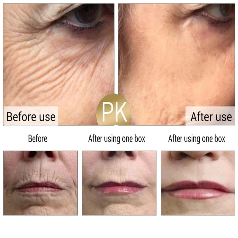 Retinol Anti-Aging Face Serum Set — Firms, Lifts & Fades Fine Lines - Gold Store Business