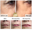 Retinol Anti-Aging Face Serum Set — Firms, Lifts & Fades Fine Lines - Gold Store Business
